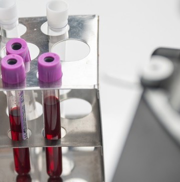 how-high-cholesterol-is-diagnosed