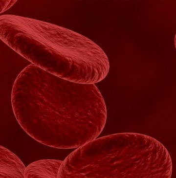 high-cholesterol-are-you-at-risk