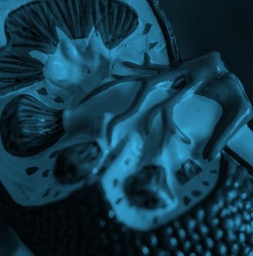 kidney-disease-nephropathy