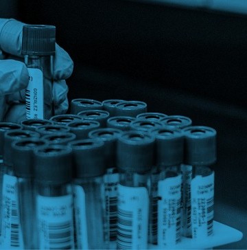 how-is-diabetes-diagnosed