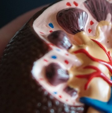 chronic-kidney-disease