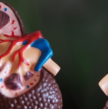 why-is-your-diet-important-for-your-kidneys